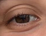 Antes